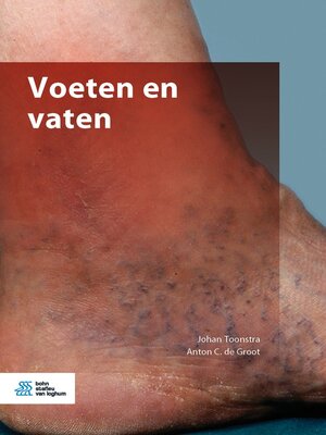 cover image of Voeten en vaten